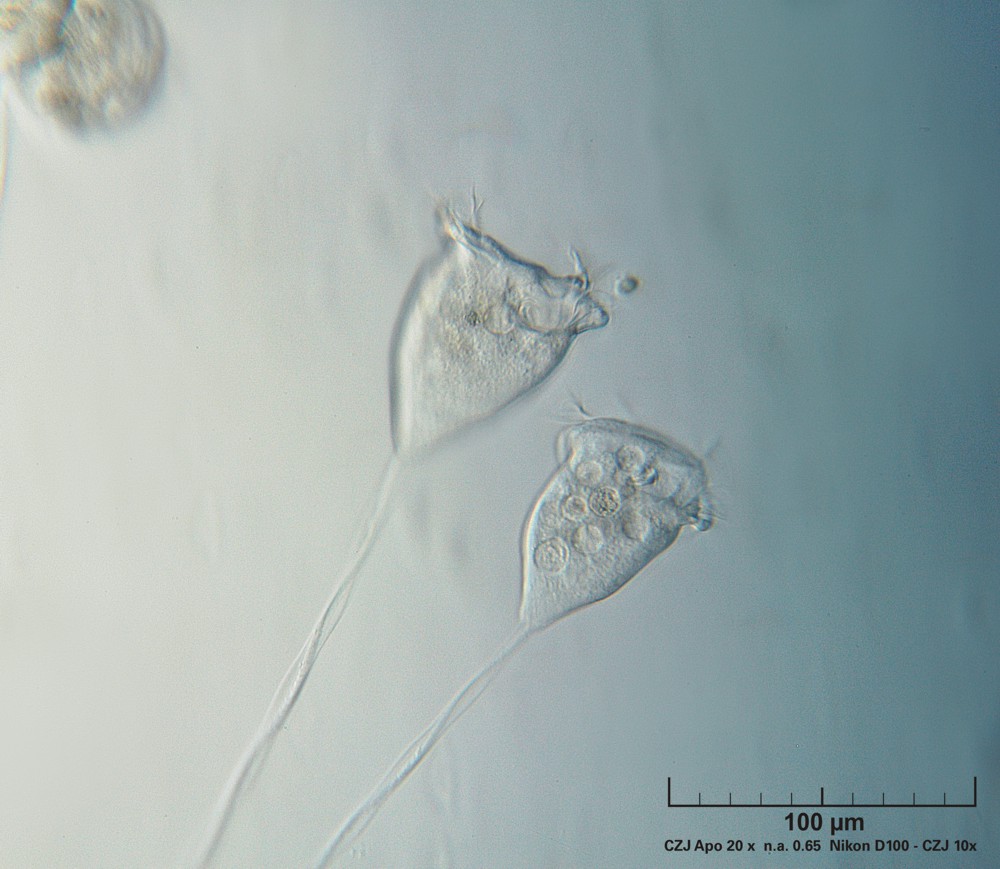 Vorticella